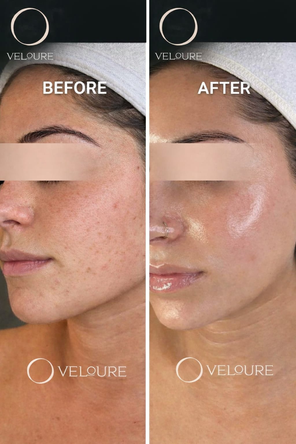 Intense Pigment Removal Duo